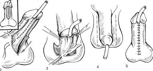 Анатомия полового члена и мочеиспускательного канала 1