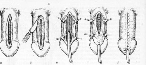 Анатомия полового члена и мочеиспускательного канала 2